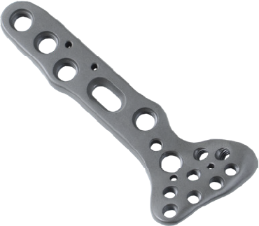 Locking Distal Radius Plate - Volar