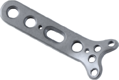 Locking Proximal Radial Head Plate