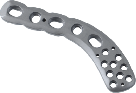 Locking Distal Clavicle Plate