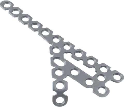 Locking Lateral Calcaneal Plate