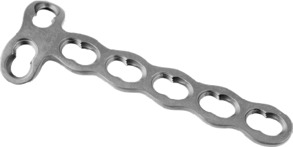 T Phalange Plate Type-I