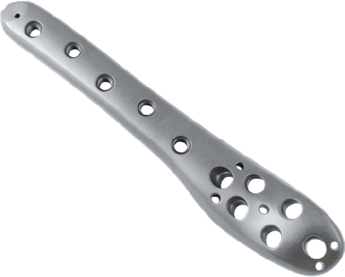 Locking Proximal Lateral Femoral Plate